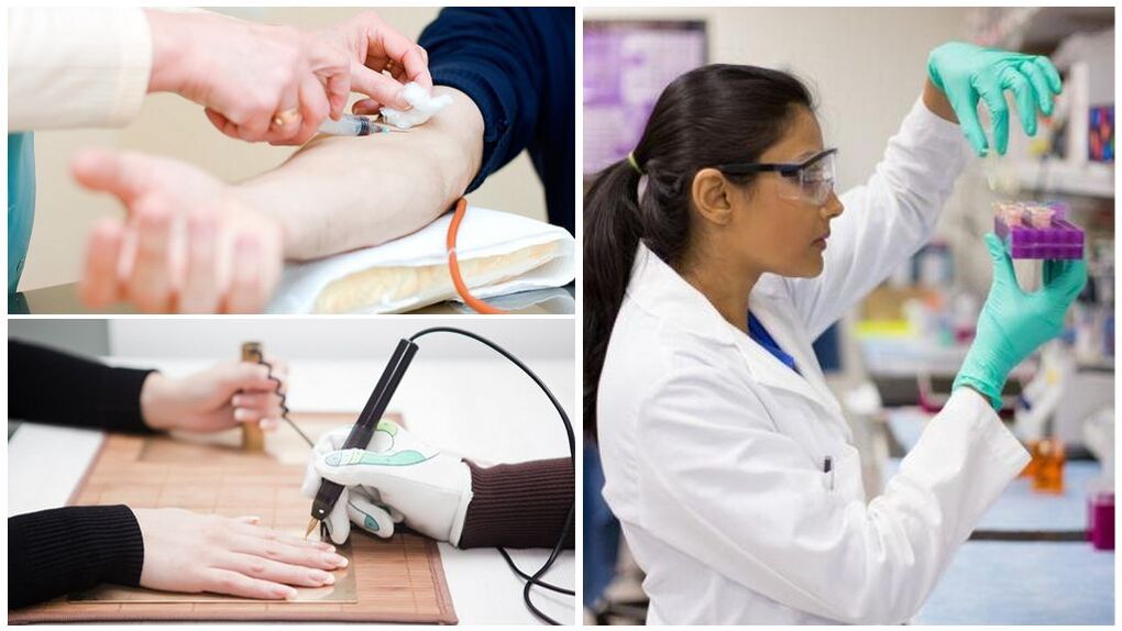 Diagnostikos metodai parazitams aptikti organizme