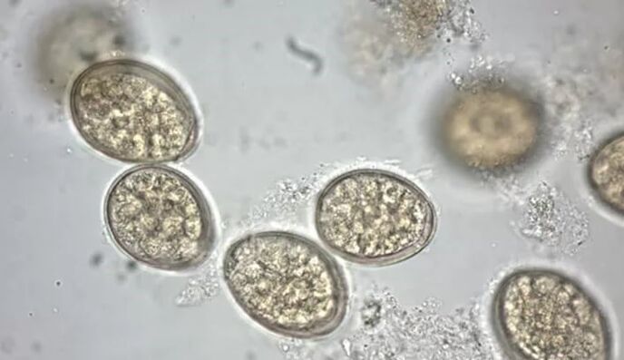 parazitai po mikroskopu