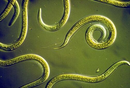 Parazitiniai nematodai žmogaus plonojoje žarnoje