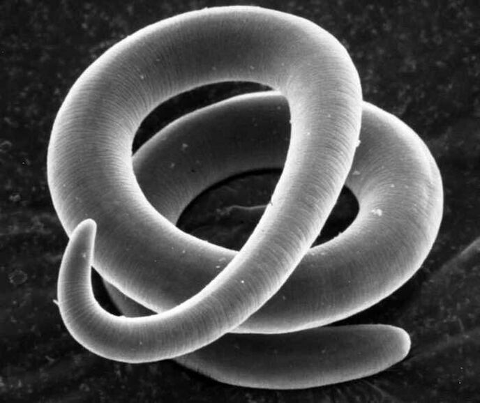Trichinella po mikroskopu